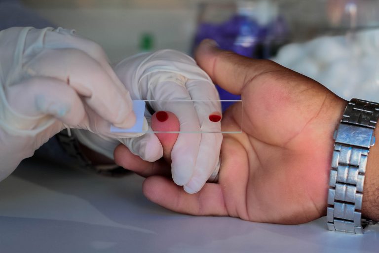 CEPEM mantém ambulatório de atendimento à malária na Capital