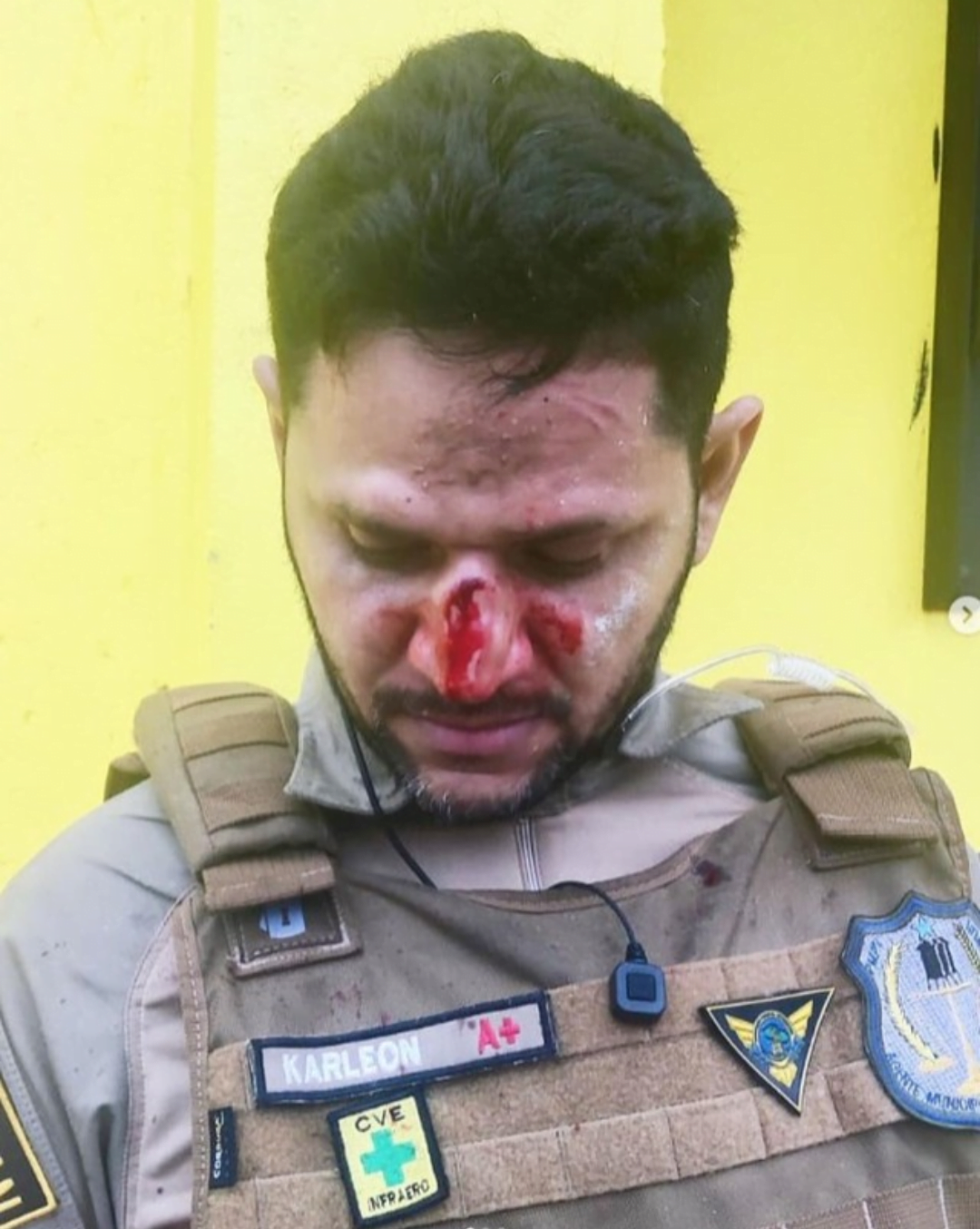 Motorista agride agente de trânsito após ser multado em Porto Velho