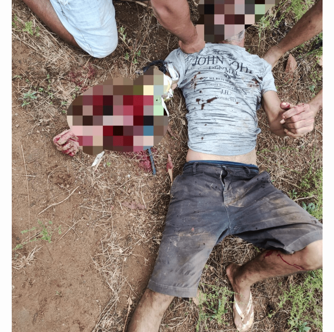 Pitbull ataca próprio dono e o deixa com o braço dilacerado