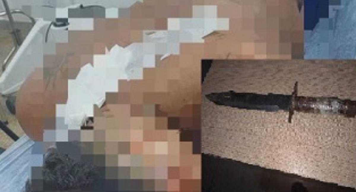Briga entre irmãos encerra com homem ferido por facada e paulada em município de Rondônia